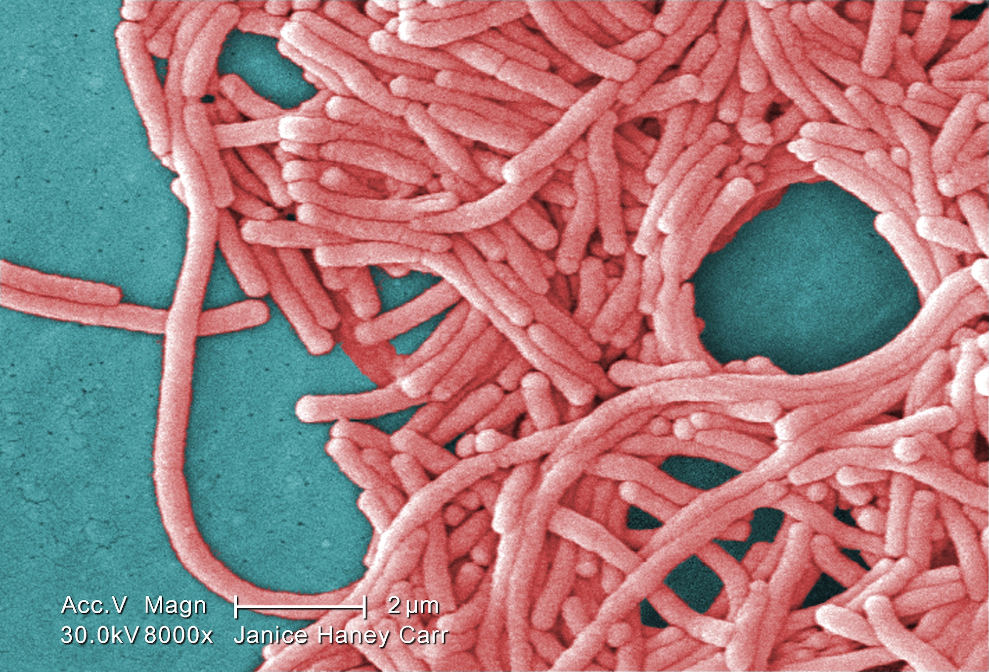 ATLANTA -- This colorized scanning electron micrograph depicts a large grouping of gram-negative legionella pneumophila bacteria under a moderately-high magnification. Legionnaires' disease, described as a serious and sometimes fatal form of pneumonia, is contracted by breathing in small droplets of water contaminated with the legionella bacteria. (Centers for Disease Control and Prevention photo by Janice Haney Carr)