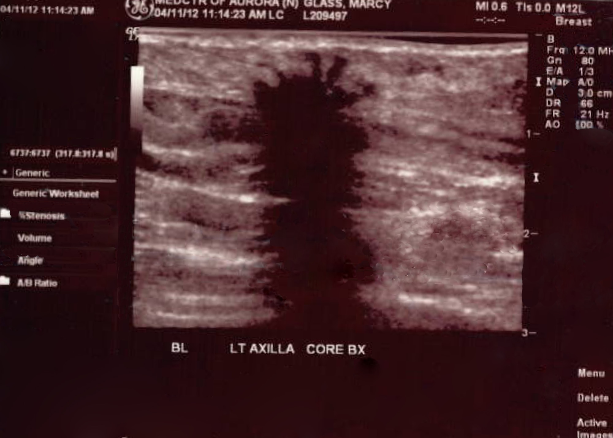AURORA, Colo. -- Ultrasound image shows a benign tumor growth. (U.S. Air Force photo provided by Senior Airman Marcy Glass)