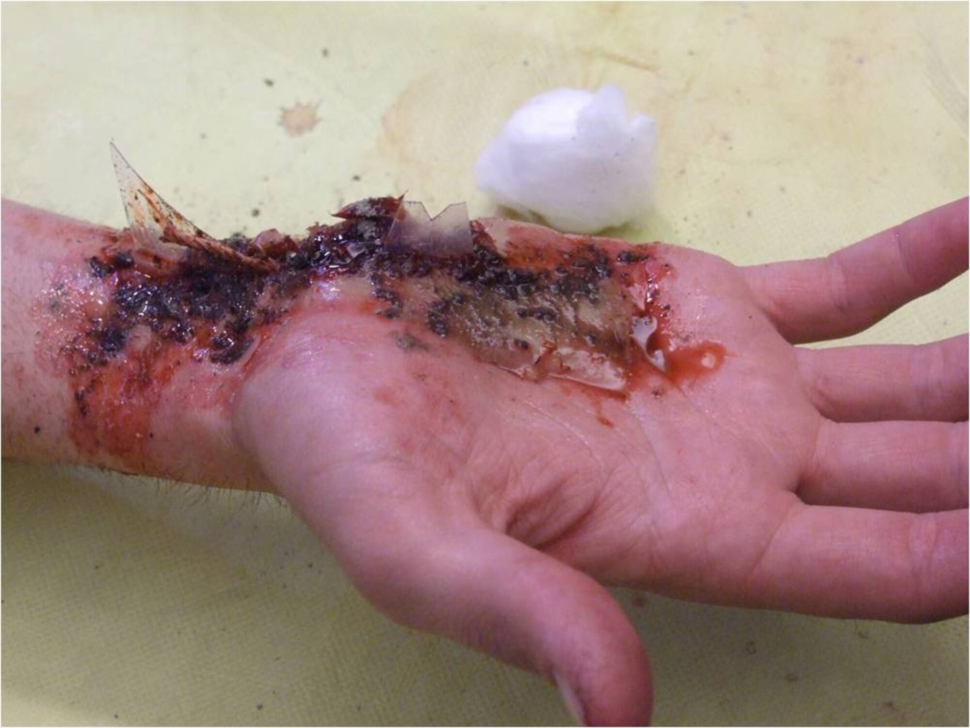 The moulage team creates wounds on acting-victims to add realistic effects which help train for emergency situations. The fake wounds can be made out of items around the home such as, makeup, honey, petroleum jelly, cocoa, and food coloring. The shards of broken glass are used from an old plastic tray. (Courtesy photo)