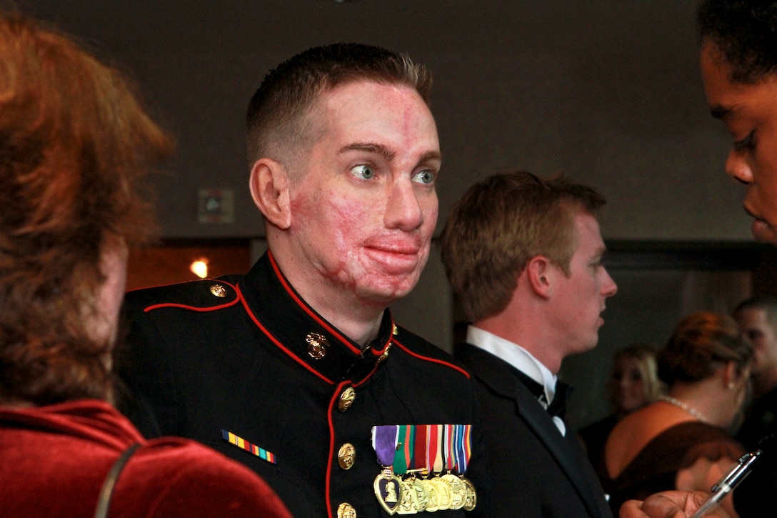 Marine Corps Cpl. Aaron P. Mankin, an Iraq War veteran, tells the story of his facial reconstruction  while attending a reception to honor Iraq War veterans in Crystal City, Va., Feb. 29, 2012. Mankin survived a bomb blast May 11, 2005, and said he has had more than 60 surgeries as the first patient of a reconstruction program at the University of California at Los Angeles. About 80 such veterans gathered at the reception before going to the White House  attend a dinner in their honor.