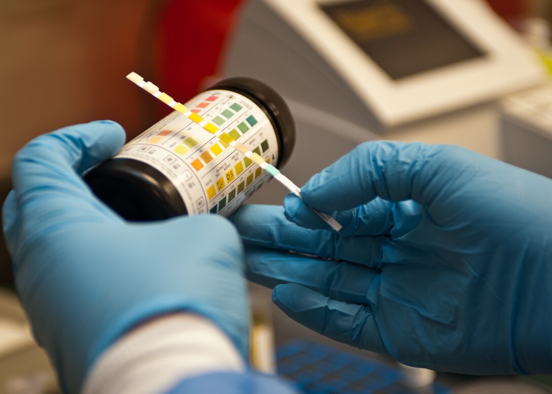 Staff Sgt. LaKosha Stephens, 432nd Attack Squadron aerospace medical technician, compares a test strip to a test chart on Ellsworth Air Force Base, S.D., March 1, 2012. This test can determine if further treatment is required to help Airmen stay healthy. (U.S. Air Force photo by Airman Alystria Maurer/Released)