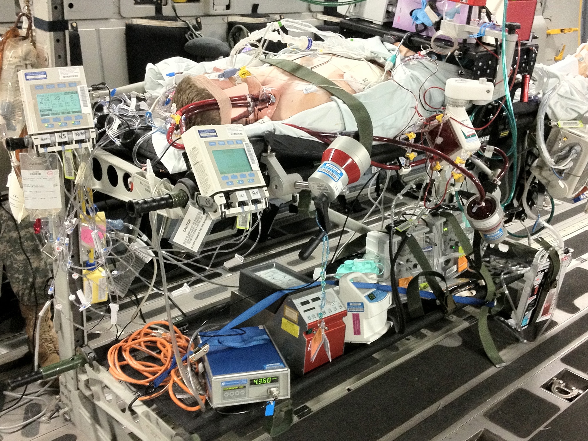 A team of Air Force, Army and civilian specialists (from Kapiolani
Medical Center), and an Air Force Critical Care Air Transport Team bring a
critical care patient from Okinawa to Joint Base Pearl Harbor-Hickam, Hawaii
to be transported to Tripler Army Medical Center.  (U.S. Air Force photo/released)
