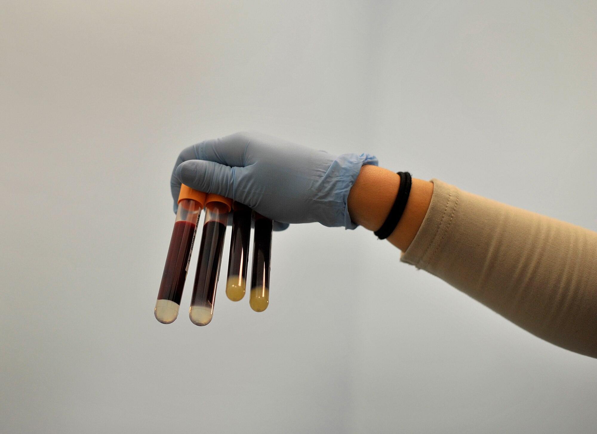 U.S. Air Force Senior Airman Aleza Chan, medical lab technician, 966th Air Expeditionary Squadron, goes through the lengthy process of testing blood from donors at the blood testing section of the NATO Role 3 Hospital, Kandahar Airfield, Afghanistan, Oct. 25, 2012. Chan is part of a five-person Air Force team that runs the apheresis program at the hospital, which helps to collect blood platelets donated by members at Kandahar. The platelets are then stored and later used to help promote blood clotting in trauma patients injured in combat. The apheresis section helps to collect platelets for not only patients at Kandahar, but also for 14 other Forward Operating Bases in Afghanistan. (U.S. Air Force photo/Staff Sgt. Clay Lancaster)