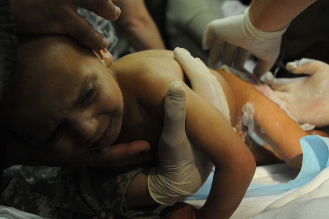 Abdul Wali, 2-yrs-old, cries as his 2nd degree deep tissue burns are being treated by Maj. Andrew Kupnowowicz, orthopedic surgeon, on Forward Operating Base Ghazni, Afghanistan.  Abdul Wali was brought to FOB Ghazni from Ajiristan for treatment on 2nd degree deep tissue burns to his buttocks and thighs.  (U.S. Air Force/Tech Sgt. Rebecca F. Corey)