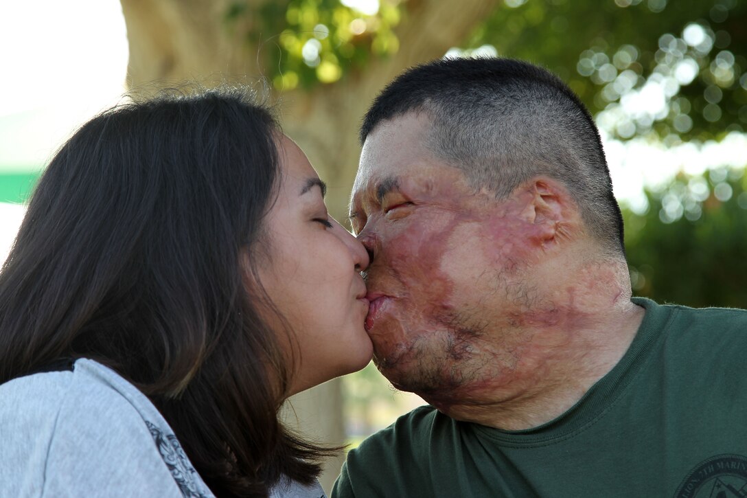 Retired Cpl. Anthony Villarreal and his wife, Jessica, share a kiss during a recent visit back to Twentynine Palms. Anthony lost 80 percent of his skin, his right arm and all the fingers on his left hand during an improvised explosive device attack in Afghanistan in June 2005. Since then, the couple has weathered through more than 70 surgeries and Anthony's neverending struggle to live as normal a life as possible. (Official USMC photo by Lance Cpl. DJ Wu)