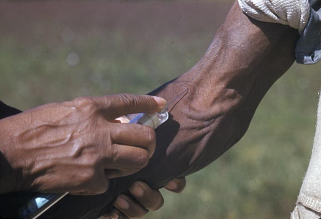 An African American male is tested and treated during the Tuskegee Study of Untreated Syphilis in the Negro Male. According to the Centers for Disease Control and Prevention, the study began in 1932 as U.S. Public Health Service medical personnel conducted these tests without the benefit of patients’ informed consent. (Courtesy photo from the Centers for Disease Control and Prevention/Released)