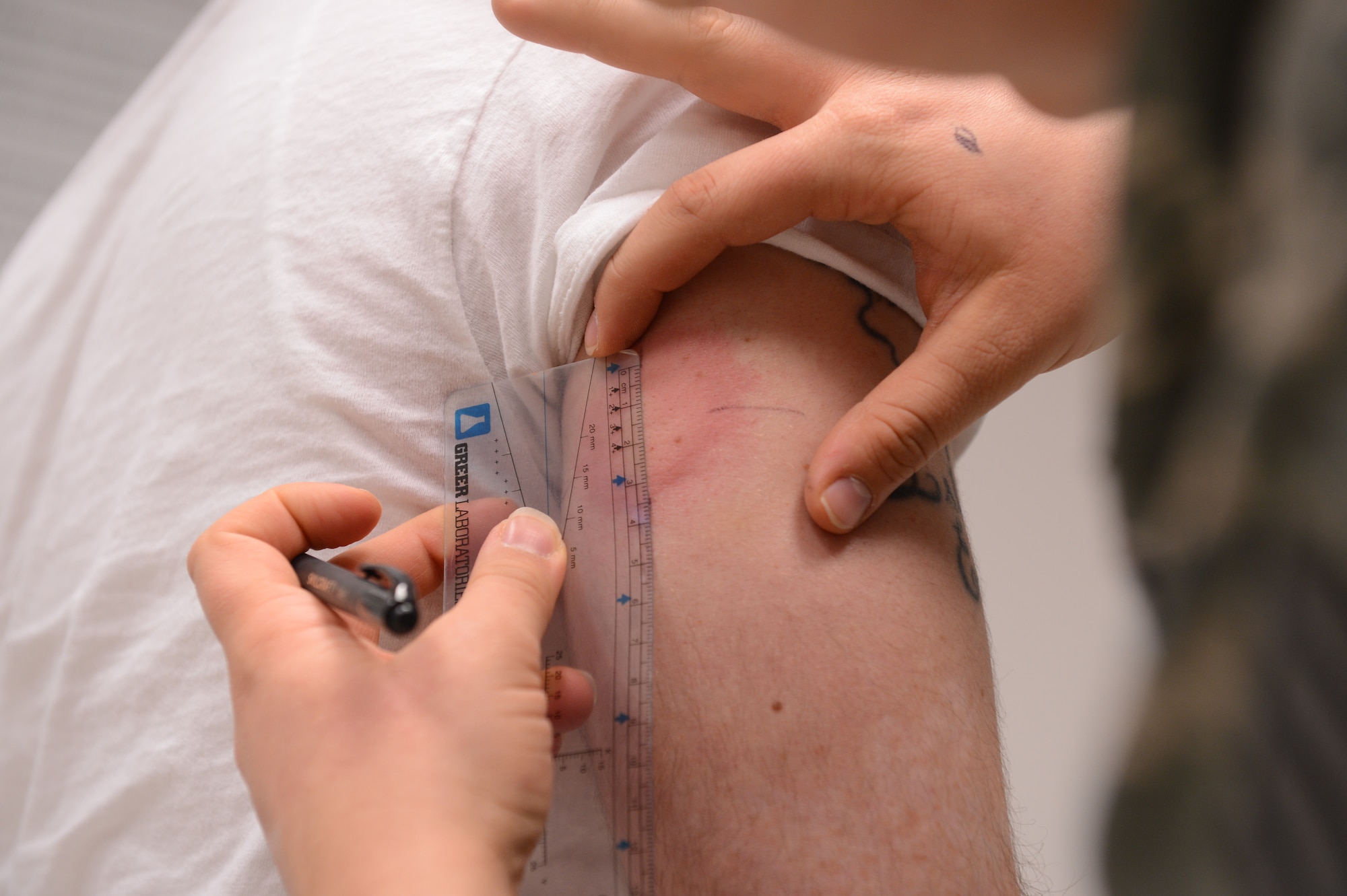 SPANGDAHLEM AIR BASE, Germany – U.S. Air Force Staff Sgt. Sarah Ellis, 52nd Medical Operations Squadron NCO in charge of Allergy Immunizations from Mount Hood, Ore., measures the swelling of a reaction on Wildmer Santiago’s arm, April 2, 2013. Allergy immunizations slowly build up the bodies’ tolerance to certain organisms which help prevent reactions. (U.S. Air Force photo by Airmen 1st Class Kyle Gese/Released)