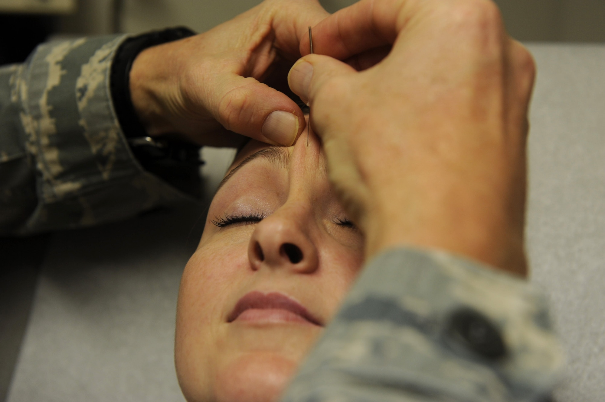 An acupuncture needle is placed on the forehead of U.S. Air Force Staff Sgt. Alesia Goosic, 18th Medical Group patient, on Kadena Air Base, Japan, April 10, 2013. Maj. Arthur Lawrance, 353rd Special Operations Support Squadron flight surgeon, works in the flight medicine section of the clinic and performs acupuncture when requested by his patients. Although Kadena does not have a full-time acupuncturist available, some bases have acupuncture clinics. (U.S. Air Force photo by Airman 1st Class Hailey R. Davis/Released)