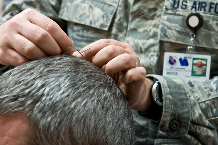 Lt. Col. (Dr.) Paul Crawford, 99th Medical Operation Squadron associate program director for Nellis Family Medicine Residency, removes acupuncture needles from U.S Army Staff Sgt. Paul Kelly’s, motor transport operator from the Community Base Warrior Transition Unit in Fort Lewis, Wash., head during his acupuncture appointment April 17, 2013, at the Mike O’Callaghan Federal Medical Center, at Nellis Air Force Base, Nev. Acupuncture is one of the key components of traditional Chinese medicine and is among the oldest healing practices in the world. (U.S. Air Force photo by Senior Airman Matthew Lancaster)