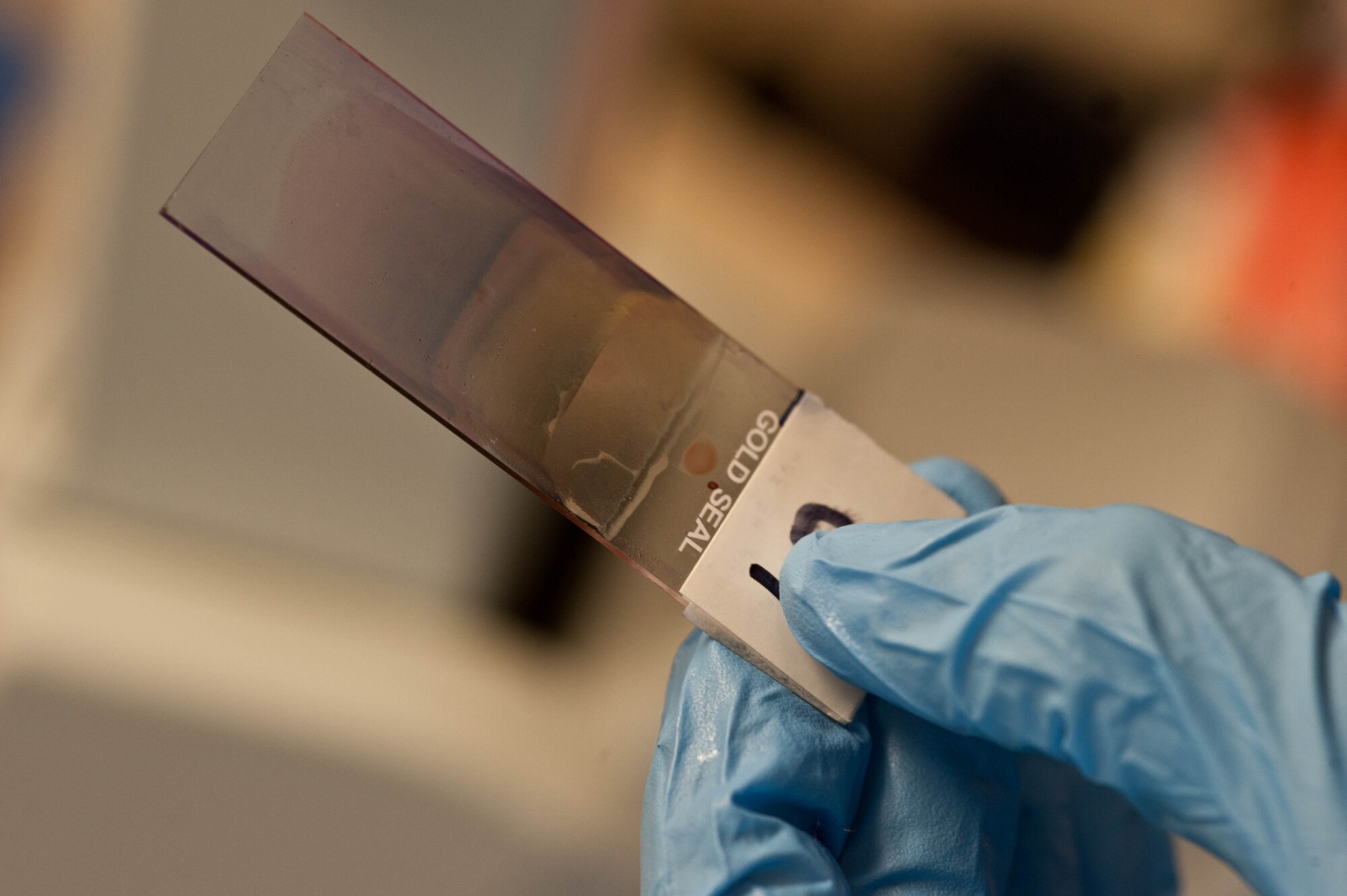 Senior Airman Lance Gillenwater, 28th Medical Support Squadron medical laboratory technician, examines a smeared blood slide in the clinical laboratory at Ellsworth Air Force Base, S.D., April 19, 2013. The stain makes it easier to tell the difference between blood cells, problem cells and parasites, producing faster and more accurate results. (U.S. Air Force photo by Airman 1st Class Zachary Hada/Released)