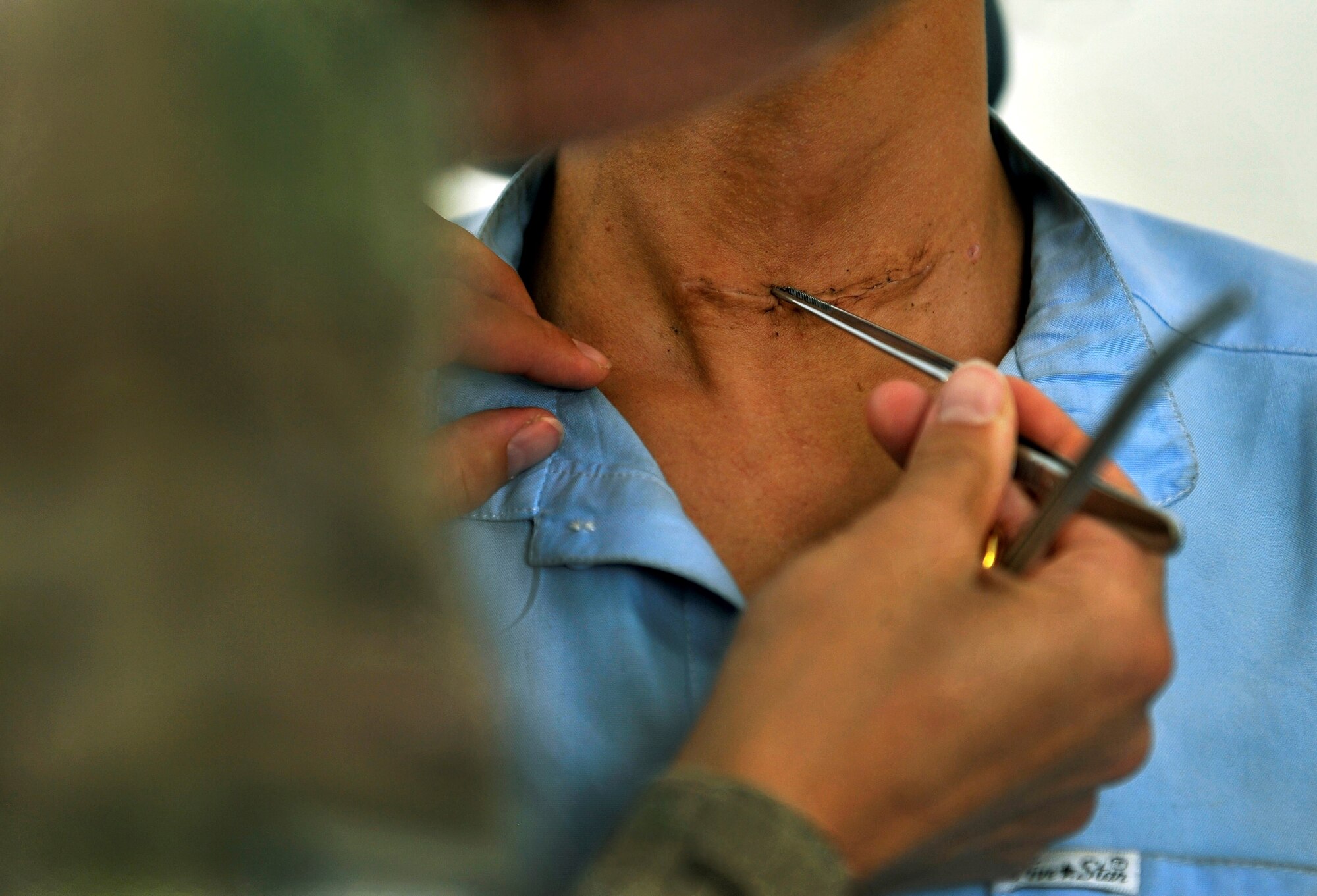 Major Jamie Swartz, second from right, examines a patient’s stitches and incision during a follow-up appointment in the Korean humanitarian hospital on Bagram Airfield, Afghanistan, July 30, 2013. Swartz, who is an otolaryngology, or ear, nose and throat surgeon assigned to the 455th Expeditionary Medical Group, she recently removed a tumor from the patient’s throat. She works in the Craig Joint Theater Hospital’s ENT clinic with her assistant Staff Sgt. Robyn Wilcox and oral surgeon, Army Lt. Col. David Thompson. (U.S. Air Force photo/Staff Sgt. Stephenie Wade)
