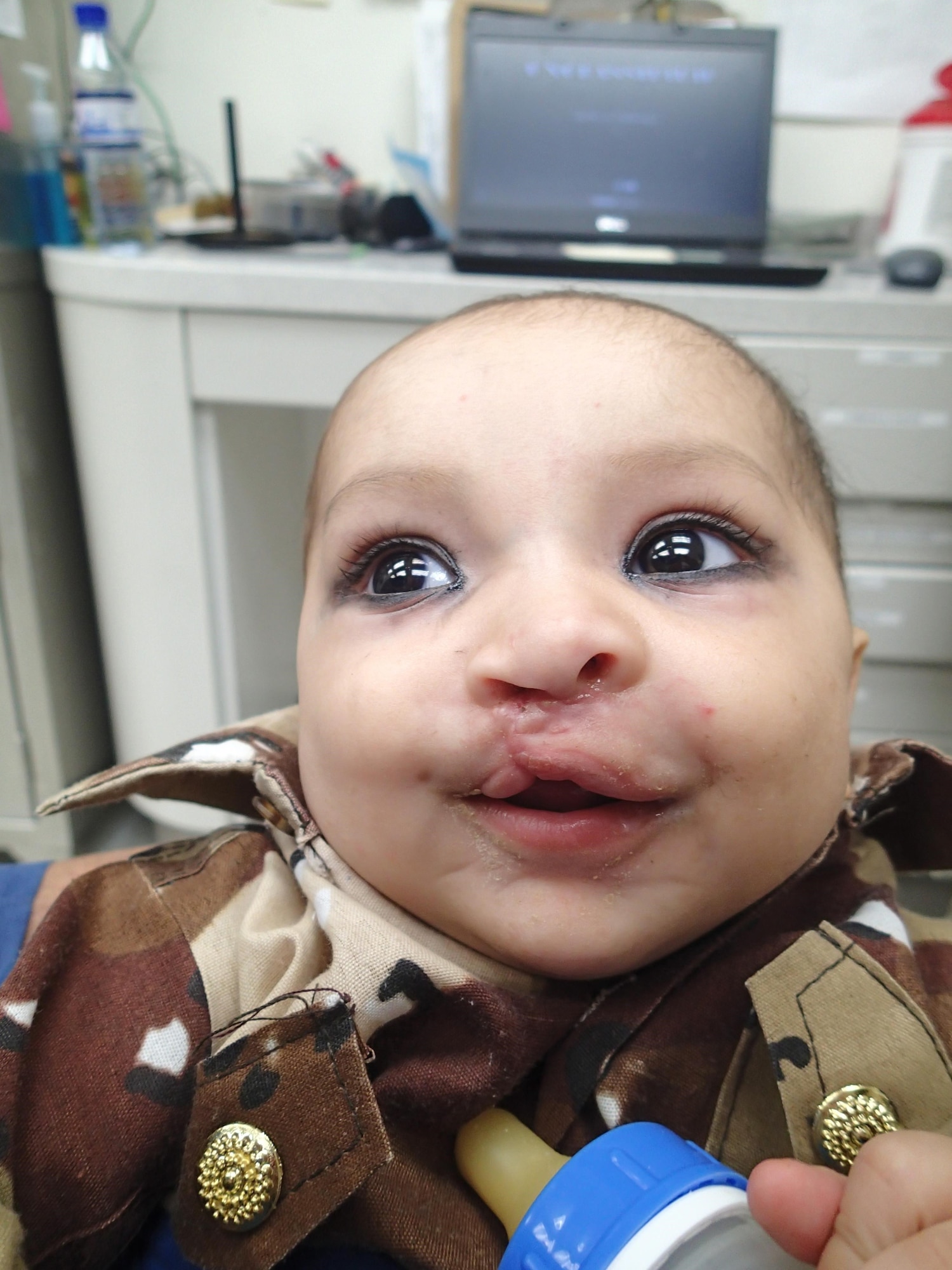 Major Jamie Swartz, 455th Expeditionary Medical Group ear, nose and throat surgeon, examines a the cleft lip on 6-month-old Afghan girl prior to performing surgery on her in the Craig Joint Theater Hospital’s operating room at Bagram Airfield, Afghanistan. She said this surgery was one the most memorable in her career thus far. Swartz is an otolaryngology deployed from Langley Air Force Base, Va.(U.S. Air Force photo/ Maj. Jamie Swartz)