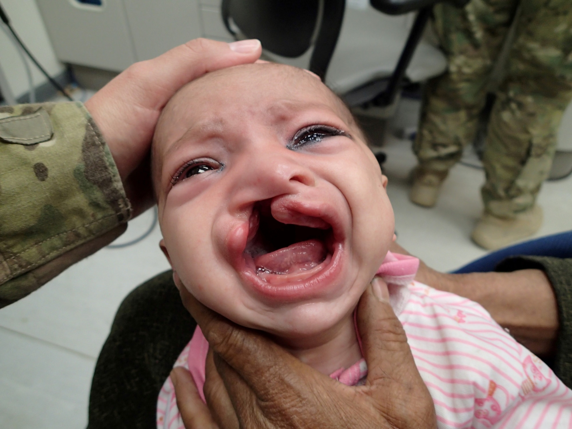 Major Jamie Swartz, 455th Expeditionary Medical Group ear, nose and throat surgeon, examines a the cleft lip on 6-month-old Afghan girl prior to performing surgery on her in the Craig Joint Theater Hospital’s operating room at Bagram Airfield, Afghanistan. She said this surgery was one the most memorable in her career thus far. Swartz is an otolaryngology deployed from Langley Air Force Base, Va.(U.S. Air Force photo/ Maj. Jamie Swartz)