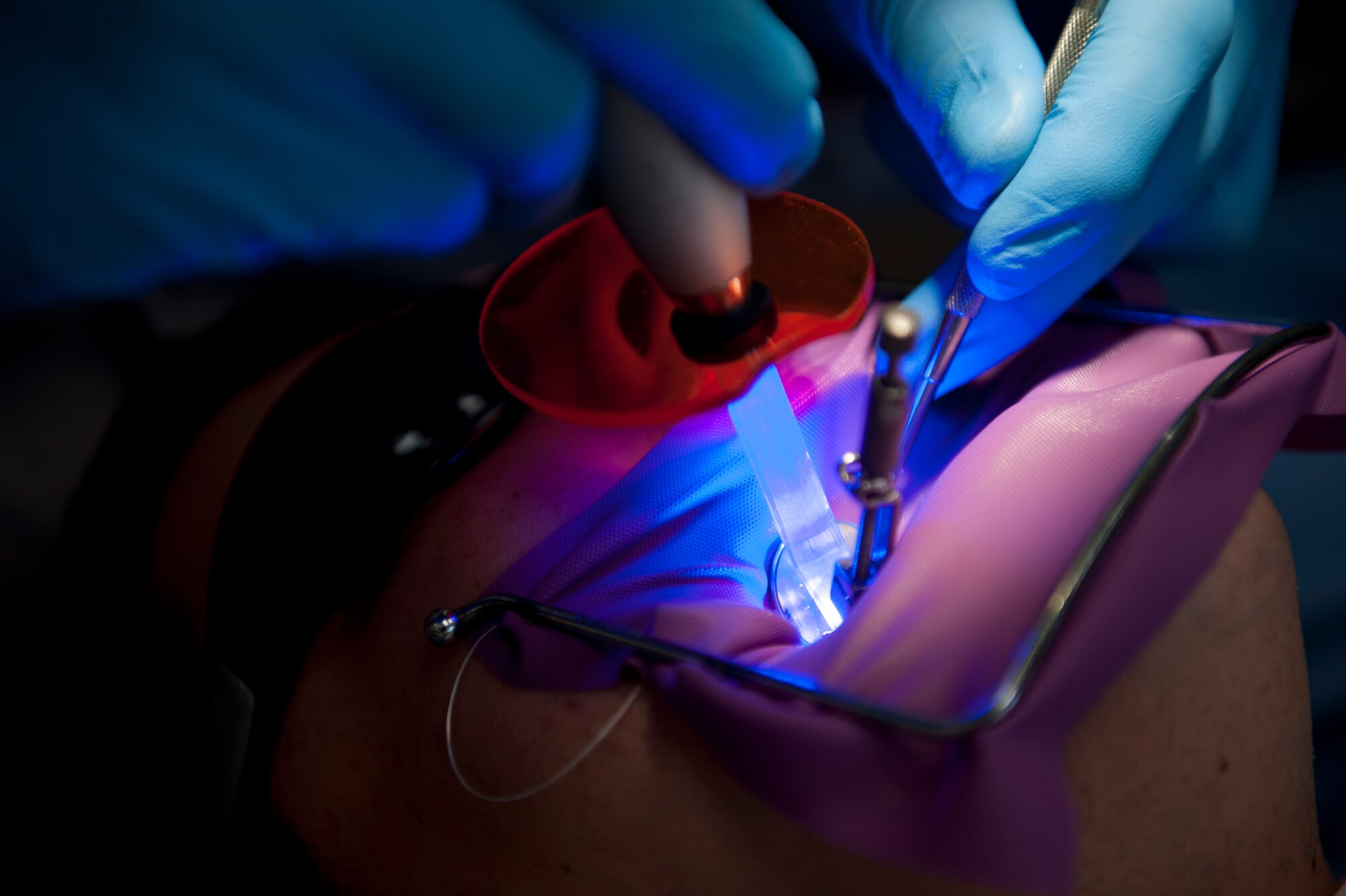 U.S. Air Force Capt. (Dr.) Nathan Fry, 366th Aerospace Medicine Squadron general dentist, uses a LED dental curing light to harden a filling Aug. 5, 2013, at Mountain Home Air Force Base, Idaho. The curing light is used on several different dental restoration materials used to treat ailments such as cavities. (U.S. Air Force Photo by Airman 1st Class Brittany A. Chase/Released)