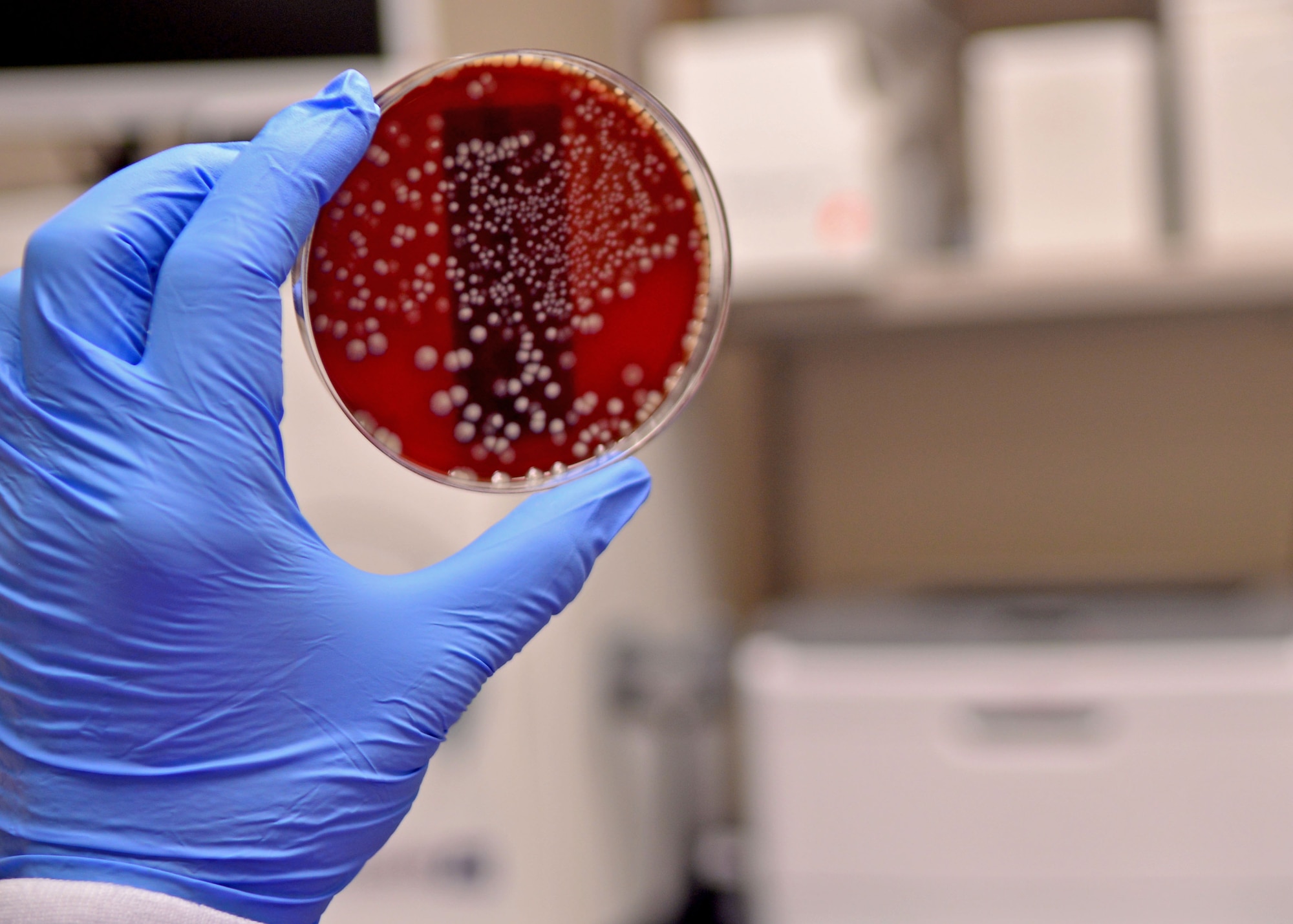 Airman 1st Class Matthew Poe, 31st Medical Support Squadron laboratory technician, examines bacteria, Aug. 21, 2013, at Aviano Air Base, Italy. The medical laboratory performs more than 90,000 tests a year, maintains a fully functional blood bank and is equipped with a microbiology lab. (U.S. Air Force photo/Airman 1st Class Briana Jones)