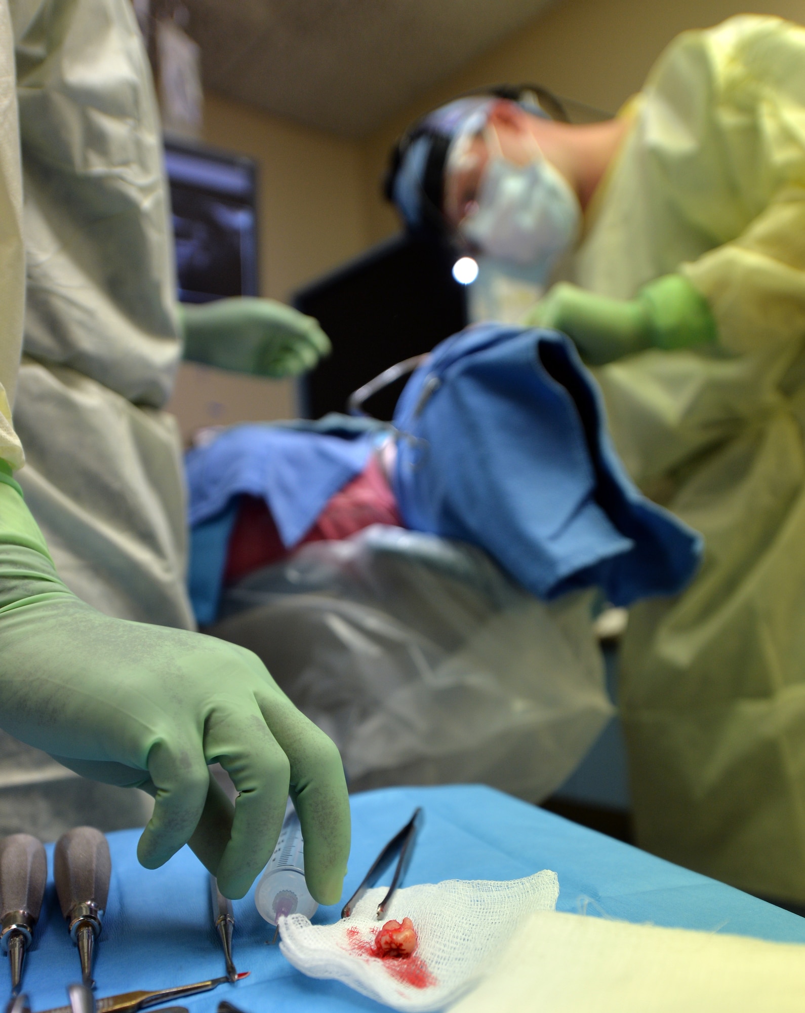 A wisdom tooth sits on a piece of gauze at the dental clinic on Hurlburt Field, Fla., Nov. 19, 2013. The dentist removed the tooth during a routine extraction. (U.S. Air Force photo/Staff Sgt. Jeff Andrejcik)    