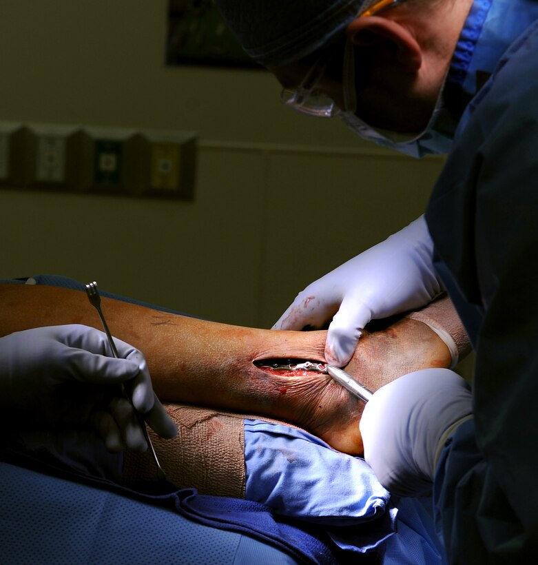 U.S. Air Force Maj. Michael Tompkins, M.D., 633rd Surgical Operations Squadron orthopedic surgeon, makes adjustments to a metal plate in a patient’s ankle during a procedure at Langley Air Force Base, Va., Feb. 5, 2013. Orthopedic complaints are the most common reason patients seek medical care. (U.S. Air Force photo by Senior Airman Teresa Aber/Released)