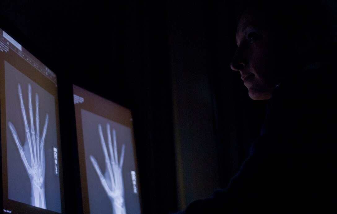 U.S. Air Force Staff Sgt. Diana Soare, 633rd Surgical Operations Squadron medical technician, shapes a forearm cast inside the new multi-service clinic at U.S. Air Force Hospital Langley at Langley Air Force Base, Va., Jan. 31, 2013. The multi-service health center not only provides an efficient space to treat patients, but also fosters a unique environment for medical providers to work closely with professionals in other specialties to ensure patients’ needs are met in an efficient, thorough manner (U.S. Air Force photo by Airman 1st Class R. Alex Durbin/Released)