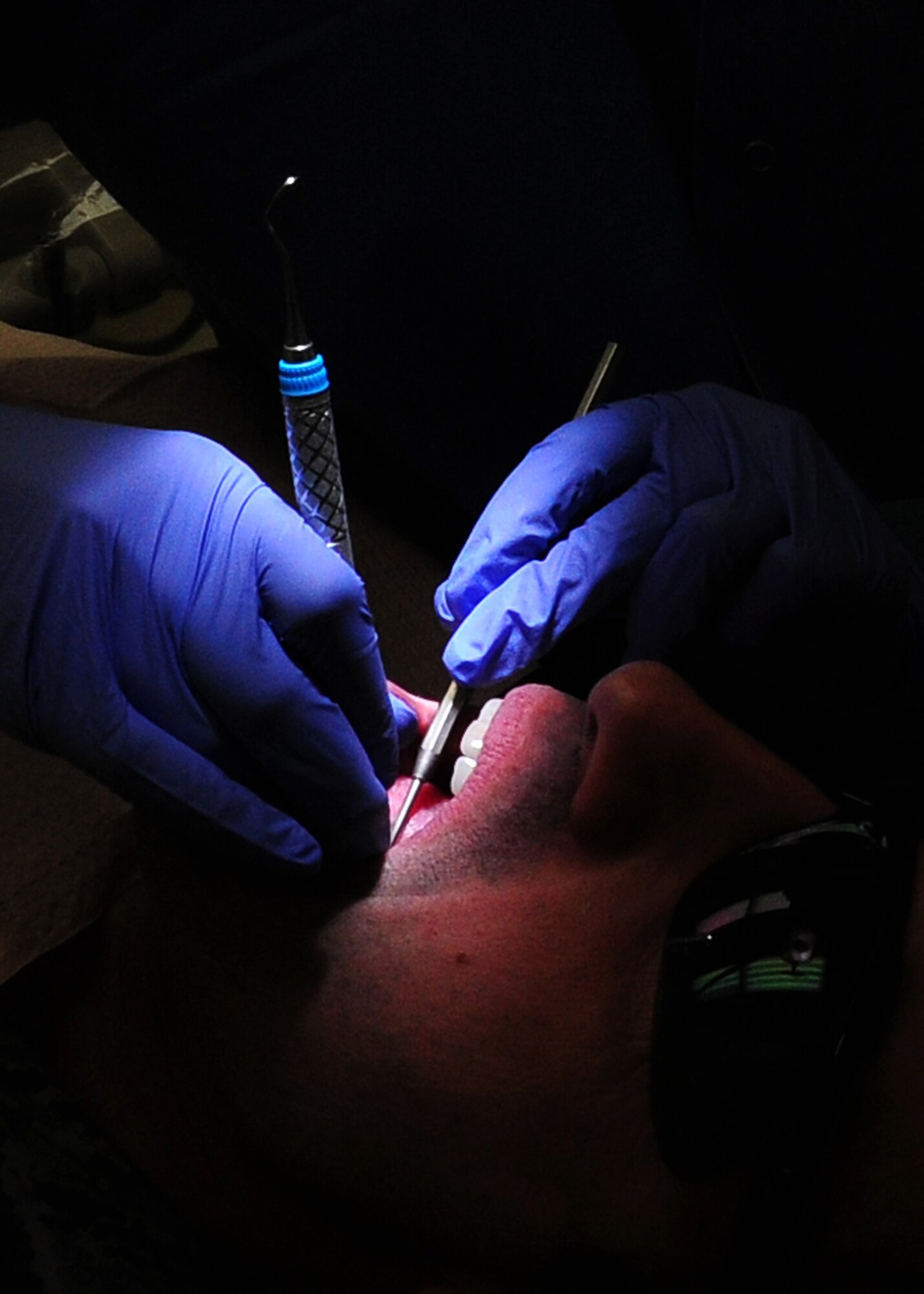 Airman 1st Class Ashley Wall, 9th Aerospace Medical Dental Squadron oral prophylaxis assistant, performs an annual cleaning exam at the dental clinic on Beale Air Force Base Calif., Feb. 8, 2013. Wall cleans and preps the patient's teeth in order for the dentist to perform the exam. (U.S. Air Force photo by Senior Airman Allen Pollard/Released)