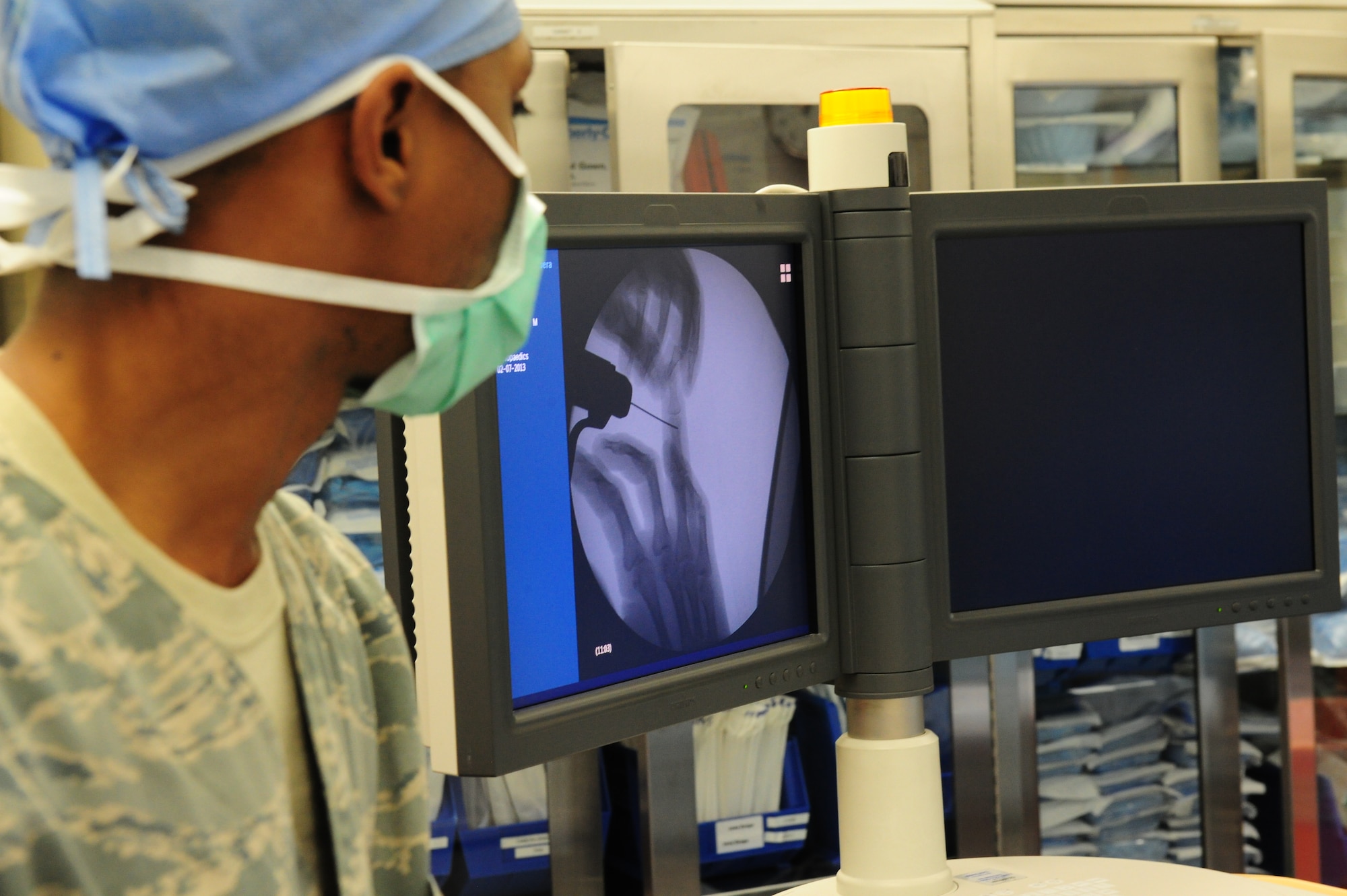 SOUTHWEST ASIA – Senior Airman Edward McCrory, 379th Expeditionary Medical Group diagnostic imaging technologist, watches as the surgeon places pins in the patient’s fractured hand Feb. 7. McCory’s job during the surgery is to provide real-time intraoperative X-ray images. McCory is a native of Atlanta, Ga., and is deployed from Joint Base Langley-Eustis, VA. (U.S. Air Force photo/Master Sgt. Brendan Kavanaugh)