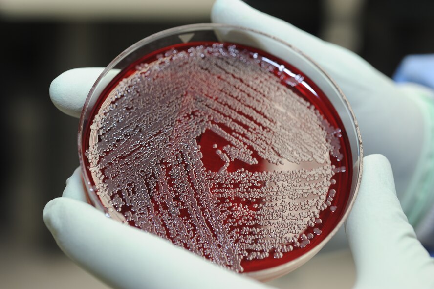 Staff Sgt. Jessica Portilla, 92nd Medical Support Squadron laboratory technician, observes a pseudomonas plate in the lab at Fairchild Air Force Base, Wash., Feb. 8, 2013. Portilla plated this strand of pseudomonas for quality control to make sure the analyzers are working properly in the laboratory.  (U.S. Air Force photo by Senior Airman Jordan Pollock) 