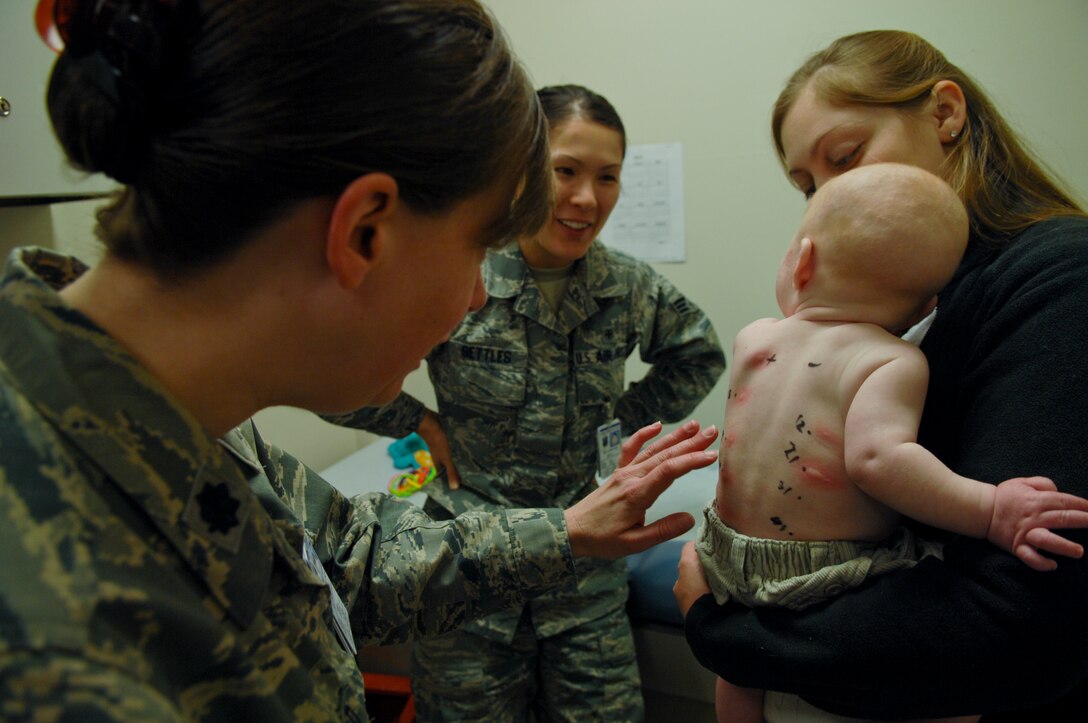Lt. Col Teresa Nesselroad, 633rd Medical Group allergist, checks the reaction of a baby after a skin prick test, Feb. 21, 2013, at U.S. Air Force Hospital Langley, Va. Skin prick tests consist of a series of tiny needles coated in an allergen inserted into the skin to test for small allergic reactions. (U.S. Air Force photo by Airman 1st Class Austin Harvill/Released)