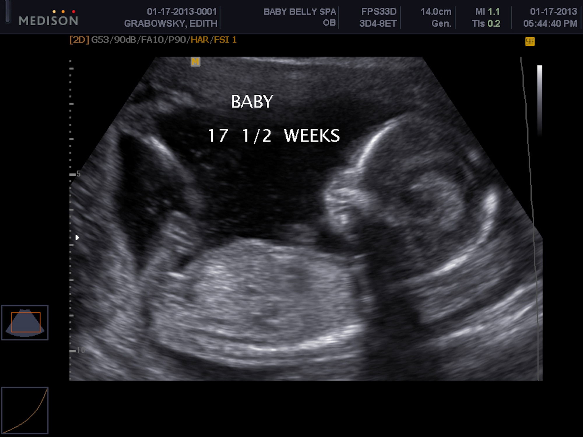 An ultrasound photo shows Renate Keller Grabowsky, unborn daughter of Tech. Sgt. Kevin and Edith Grabowsky. Grabowsky is serving a six-month tour at Kandahar Airfield, Afghanistan, with the 451st Expeditionary Maintenance Squadron as the production supervisor of conventional munitions. After a few weeks into his tour, Grabowsky learned that his wife is pregnant with his first child. (U.S. Air Force photo by Staff Sgt. Kenny Holston/Released) 