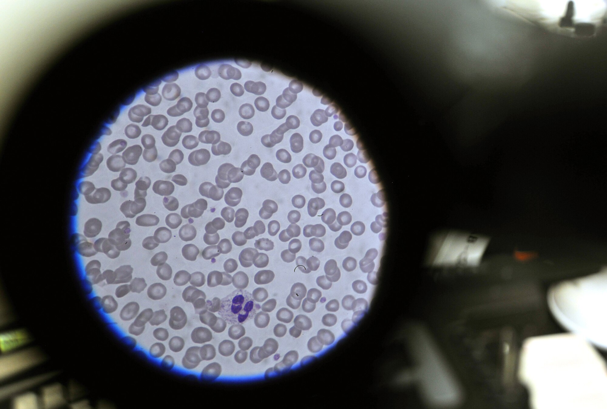 Blood cells are examined through a microscope at the Craig Joint Theater Hospital on Bagram Airfield, Afghanistan, Jan. 24, 2013. The 455th Expeditionary Medical Support Squadron laboratory technicians constantly monitor the stocked blood through quality control measures to ensure safety and proper distribution to the hospital patients. (U.S. Air Force photo/Senior Airman Chris Willis)