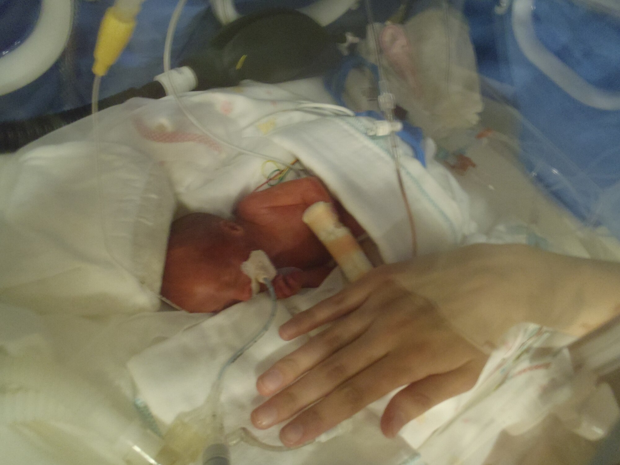 Jenson Alton, pictured here, beside his mother’s hand, was born weighing 1.4 lb. He and his twin sister were delivered in Yokota, Japan, four months early. (photo courtesy of parents)