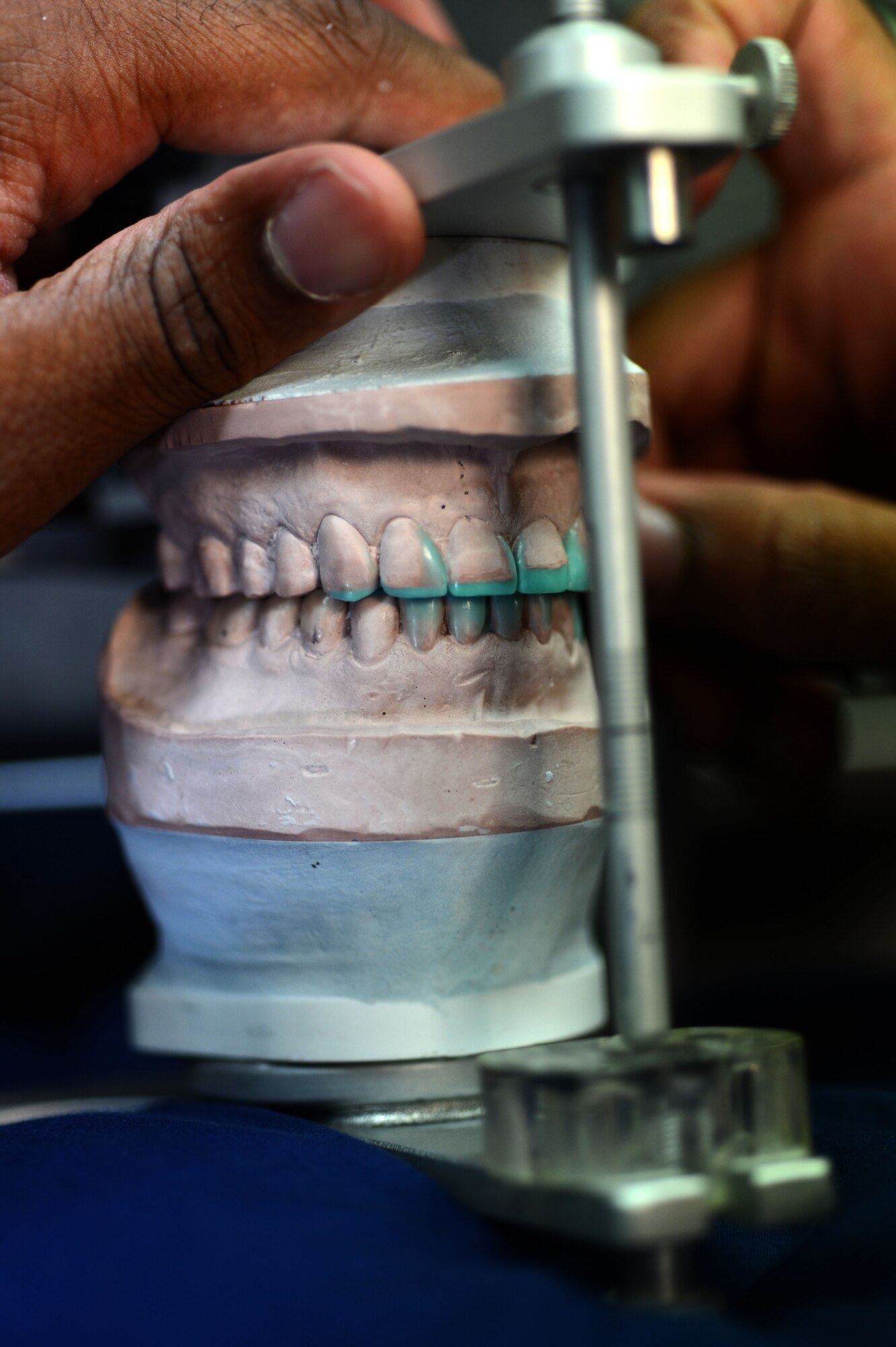 SPANGDAHLEM AIR BASE, Germany – U.S. Air Force Staff Sgt. Le Gendre Herrera, 52nd Dental Squadron dental laboratory technician from Trinidad and Tobago, observes the contact points on the mold of a patient’s mouth July 16, 2013. Herrera sculpts each tooth individually to ensure each contact point of the mold fits correctly. (U.S. Air Force photo by Airman 1st Class Gustavo Castillo/Released)  