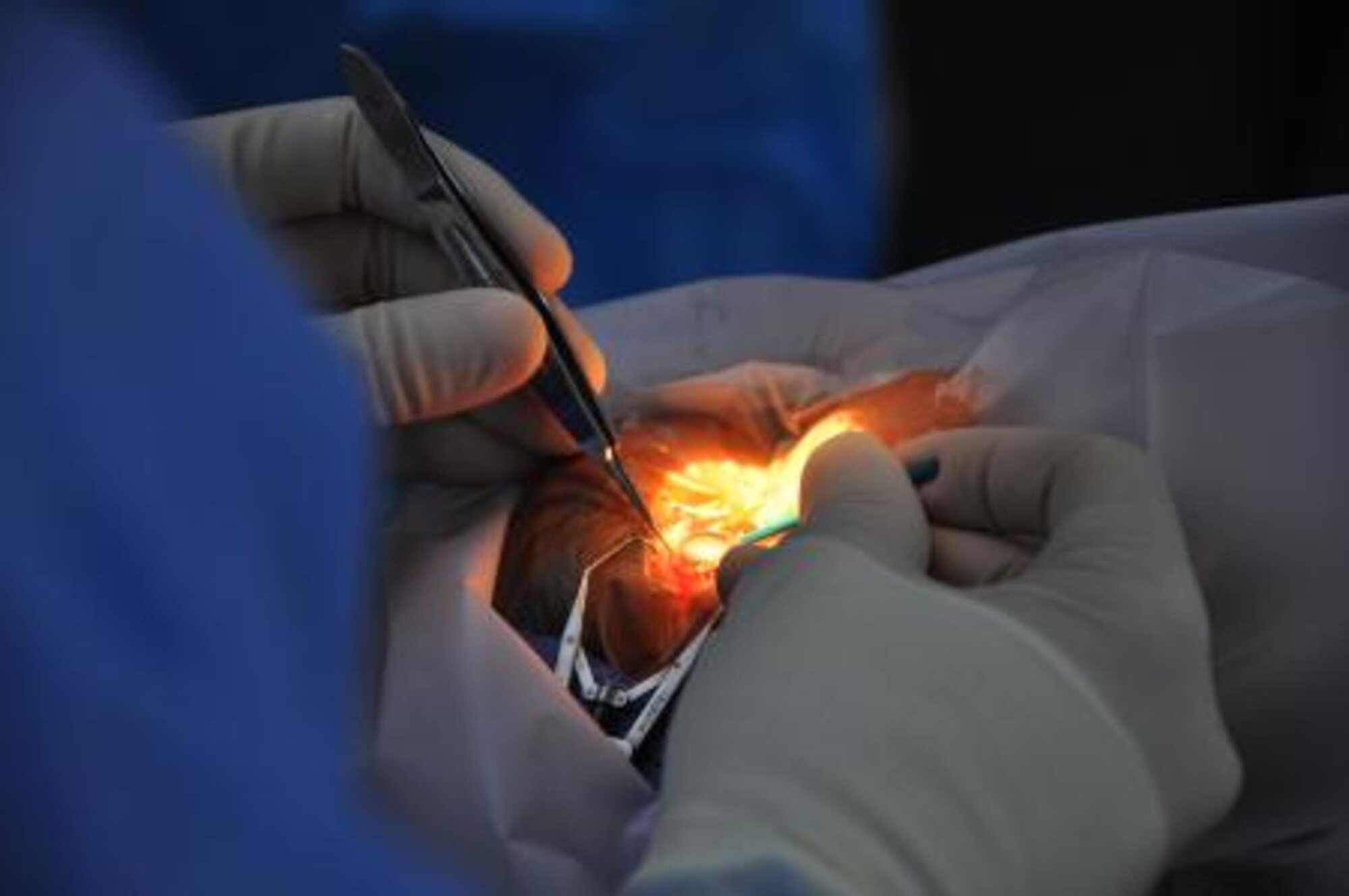 U.S. Air Force Maj. (Dr.) Richard Townley, cornea and refractive surgeon from the 59th Medical Wing at Wilford Hall Ambulatory Surgical Center at Lackland Air Force Base, Texas, performs cataract surgery on a patient June 5, 2013, at the Southern Regional Hospital in Dangriga, Belize. Military medical professionals from the U.S. and Canada have provided free medical treatment throughout Belize as part of an exercise known as New Horizons. The medical readiness training exercises are designed to provide humanitarian assistance and medical care to people throughout Belize, while helping improve the skills of U.S. military medical forces. (U.S. Air Force photo by Capt. Holly Hess/Released)