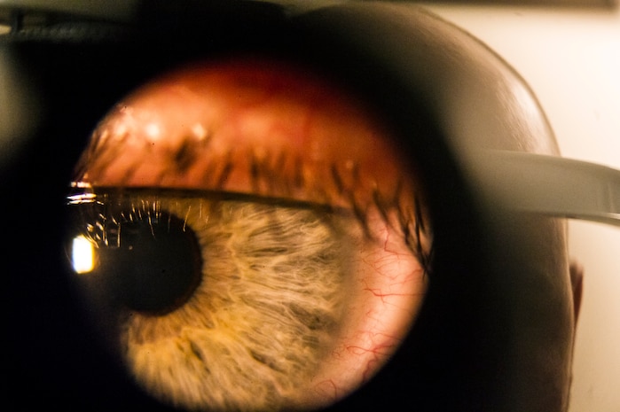 A human eye is pictured through a phoropter June 17, 2013, at Joint Base Charleston – Air Base, S.C. The optometry clinic provides eye care to active-duty service members and reservists on special orders. The most common services provided are eye examinations, visual acuity checks, repairing glasses, color vision tests and comprehensive exams. (U.S. Air Force photo/ Senior Airman George Goslin)