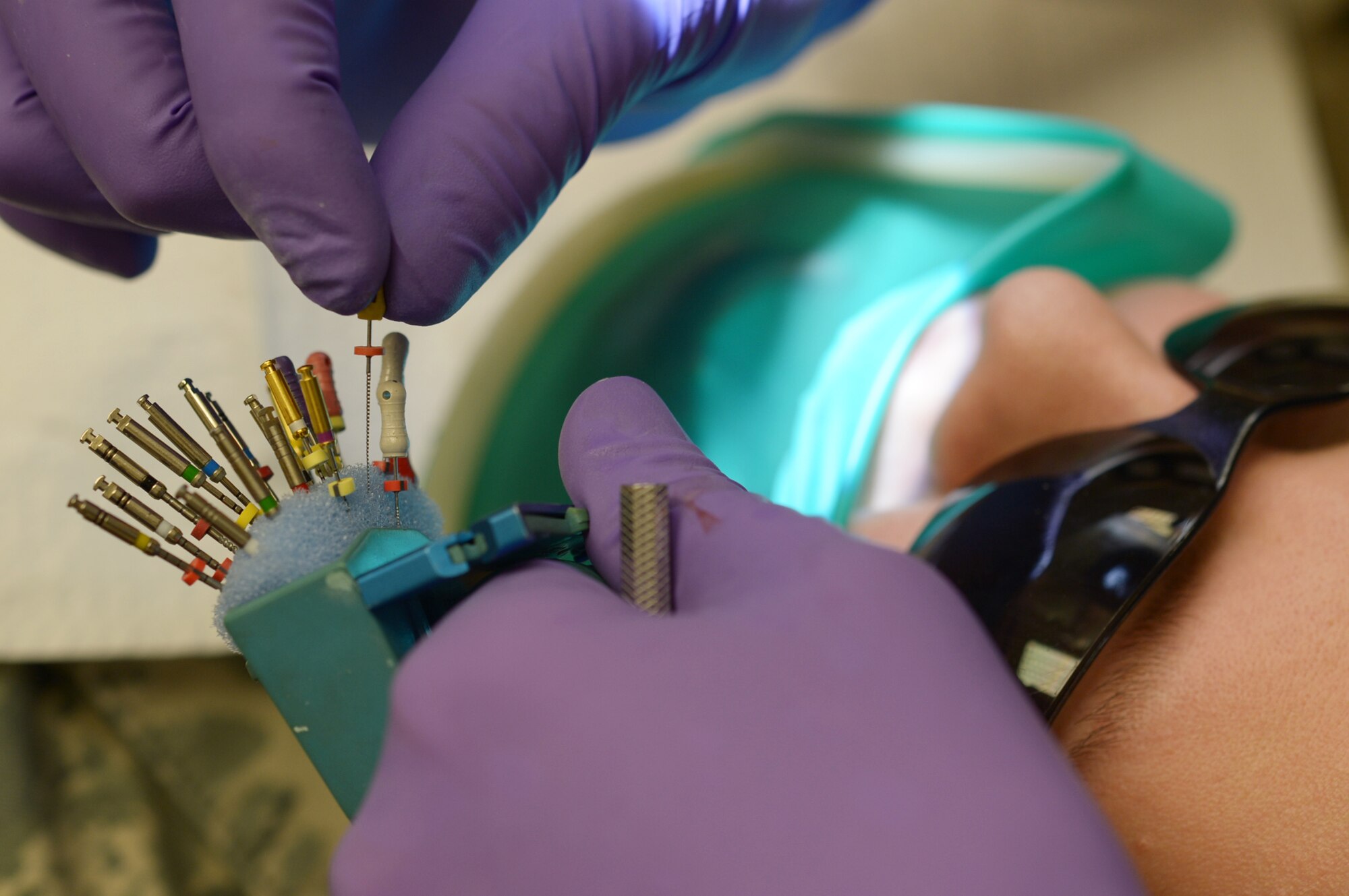 ROYAL AIR FORCE LAKENHEATH, England - Multiple sized files are placed in a sponge in between use during a root canal Feb. 27, 2013. Varying file sizes are used to ensure that the canals are thoroughly cleaned. Root canal treatment addresses diseases of the pulpal tissue inside the tooth and roots. (U.S. Air Force photo by Senior Airman Lausanne Morgan)