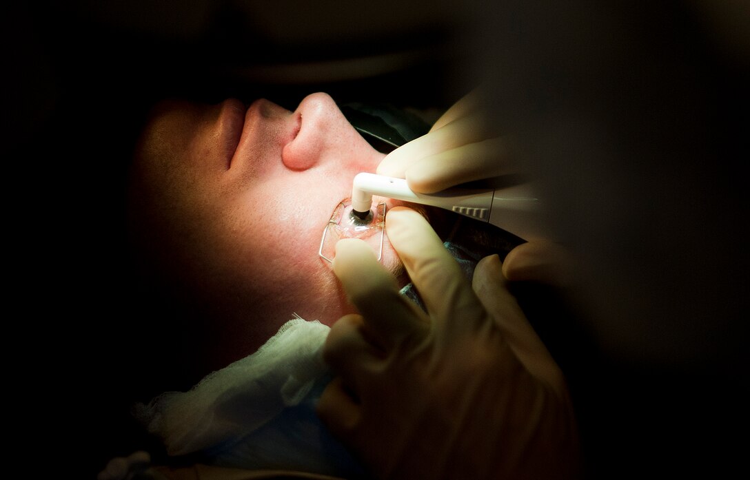 Col. Joseph A. Giovannini, M.D. uses Rotary Epithelial Scrubber to remove an accurate amount of epithelium cells without trauma to 811th Security Forces Squadron response force member, Airman 1st Class J.D. Whelihan’s eye at Joint Base Andrews, Md. The laser can now reshape the eye as needed for the patient's prescription.(U.S. Air Force photo by Staff Sgt. Perry Aston)