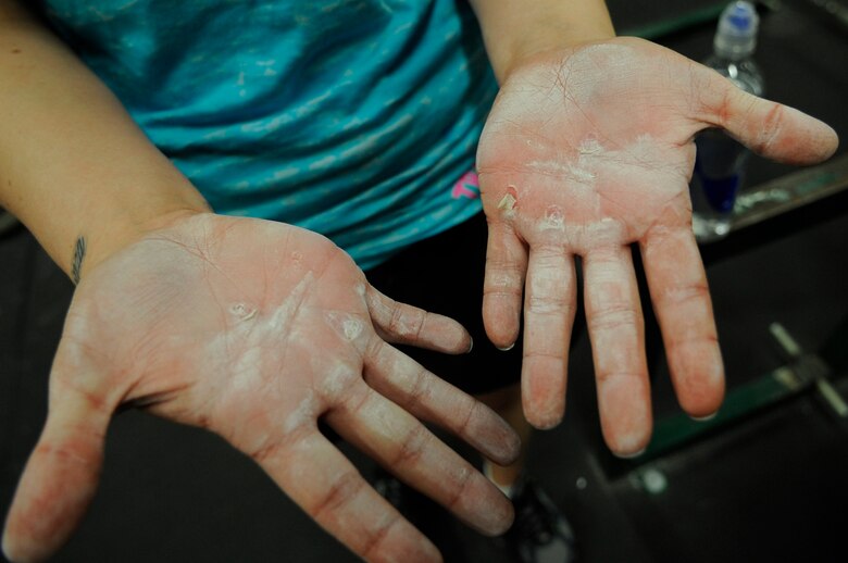 Staff Sgt. Samantha Scott, 509th Bomb Wing Command Post training manager, shows off her blisters formed during her weighted bar and pull-ups exercises during the K-State CrossFit Challenge in Manhattan, Kan., April 27, 2013. (U.S. Air Force photo by Staff Sgt. Alexandra M. Boutte/Released)