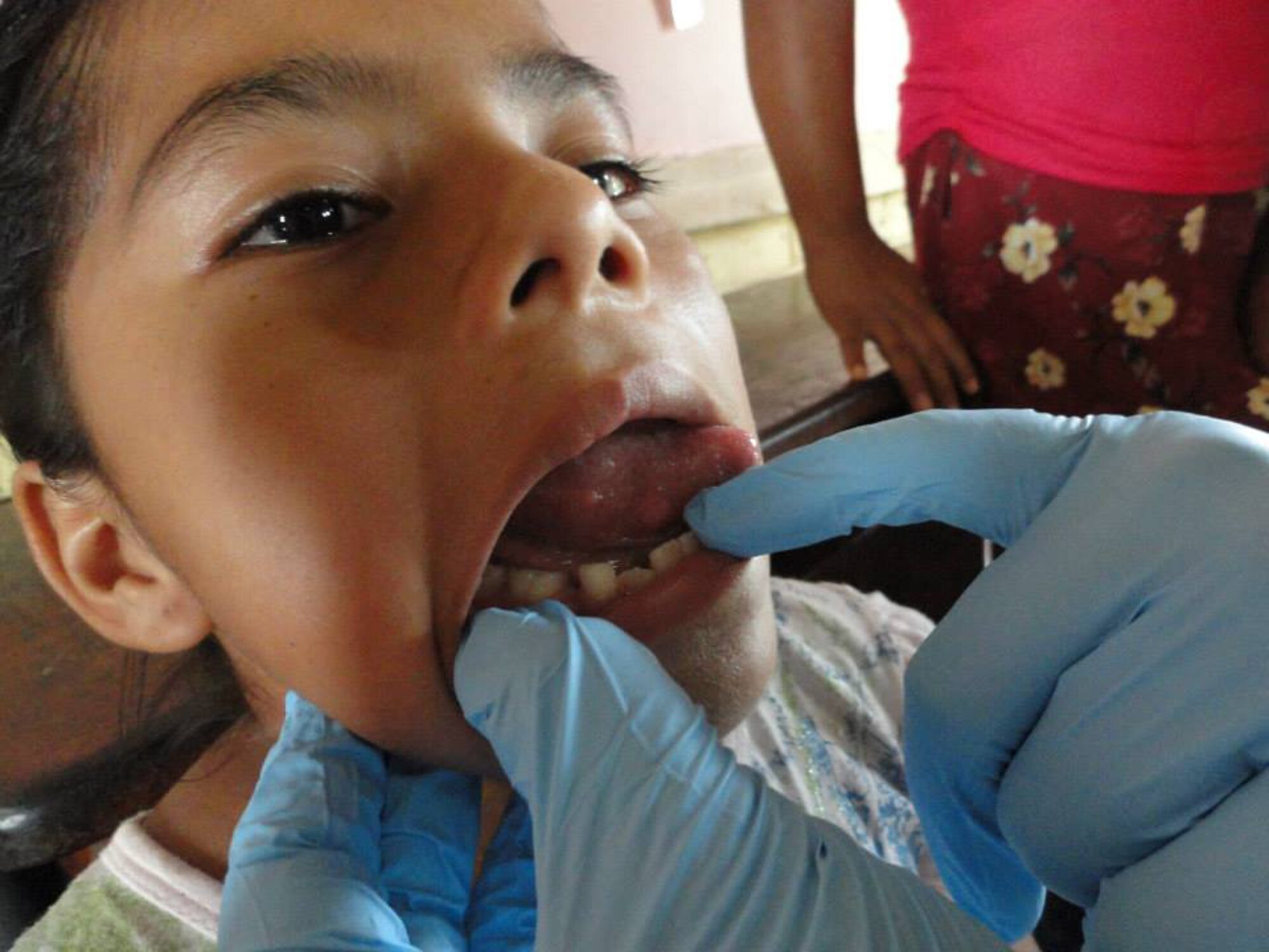 The U.S. Southern Command joint humanitarian assistance exercise, New Horizons, provides ear, nose and throat surgical procedures and hearing aids to patients across Central America. Maxwell Airmen combined with Canadian military and U.S. Marines to establish free medical clinics and continue construction on developmental projects, including four schools. (U.S. Air Force photo by Capt. Charles Pace)
