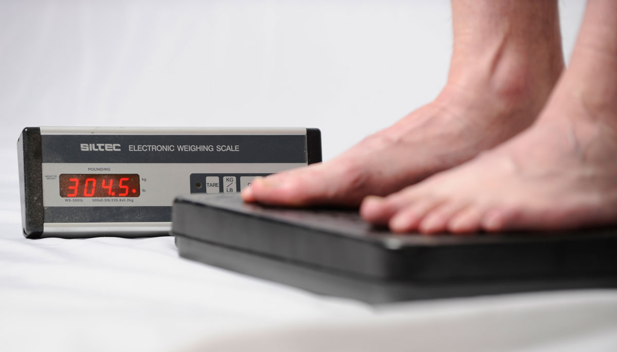 673d Bariatric Surgery clinic can help you shed pounds