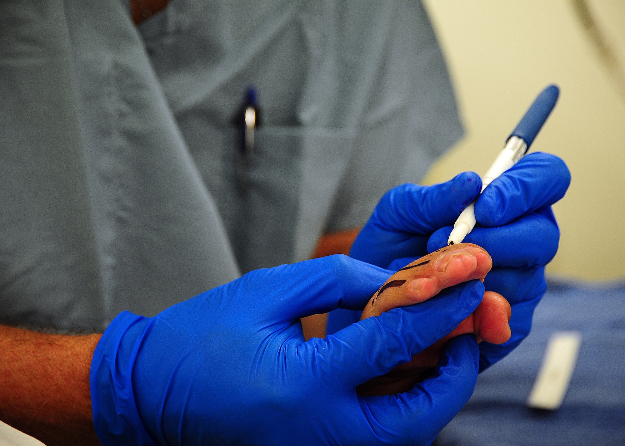 Lt. Col. Talarczyk uses a surgical marking pen to outline Isai’s hand before the procedure. (Air Force photo by Tech. Sgt. Tony Tolley)