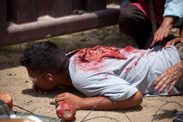 MARINE CORPS TRAINING AREA BELLOWS, Hawaii - A role-player with a mock wound during noncombatant evacuation operation training for Marines with Fox Company, 2nd Battalion, 3rd Marine Regiment at Marine Corps Training Area Bellows military operations on urban terrain town, May 16. (U.S. Marine Corps photo by Lance Cpl. Suzanna Lapi)