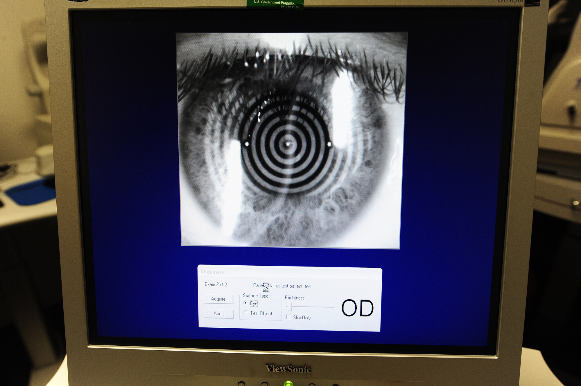 An orb scan is used to evaluate a patient’s eye in the optometry clinic at Whiteman Air Force Base, Mo., Sept. 4, 2013. The orb scan measures the curvature of the cornea of a patient’s eye. The rings on the screen help evaluate curvature changes and provide a topographical image of the corneal surface. (U.S. Air Force photo by Staff Sgt. Nick Wilson/Released)