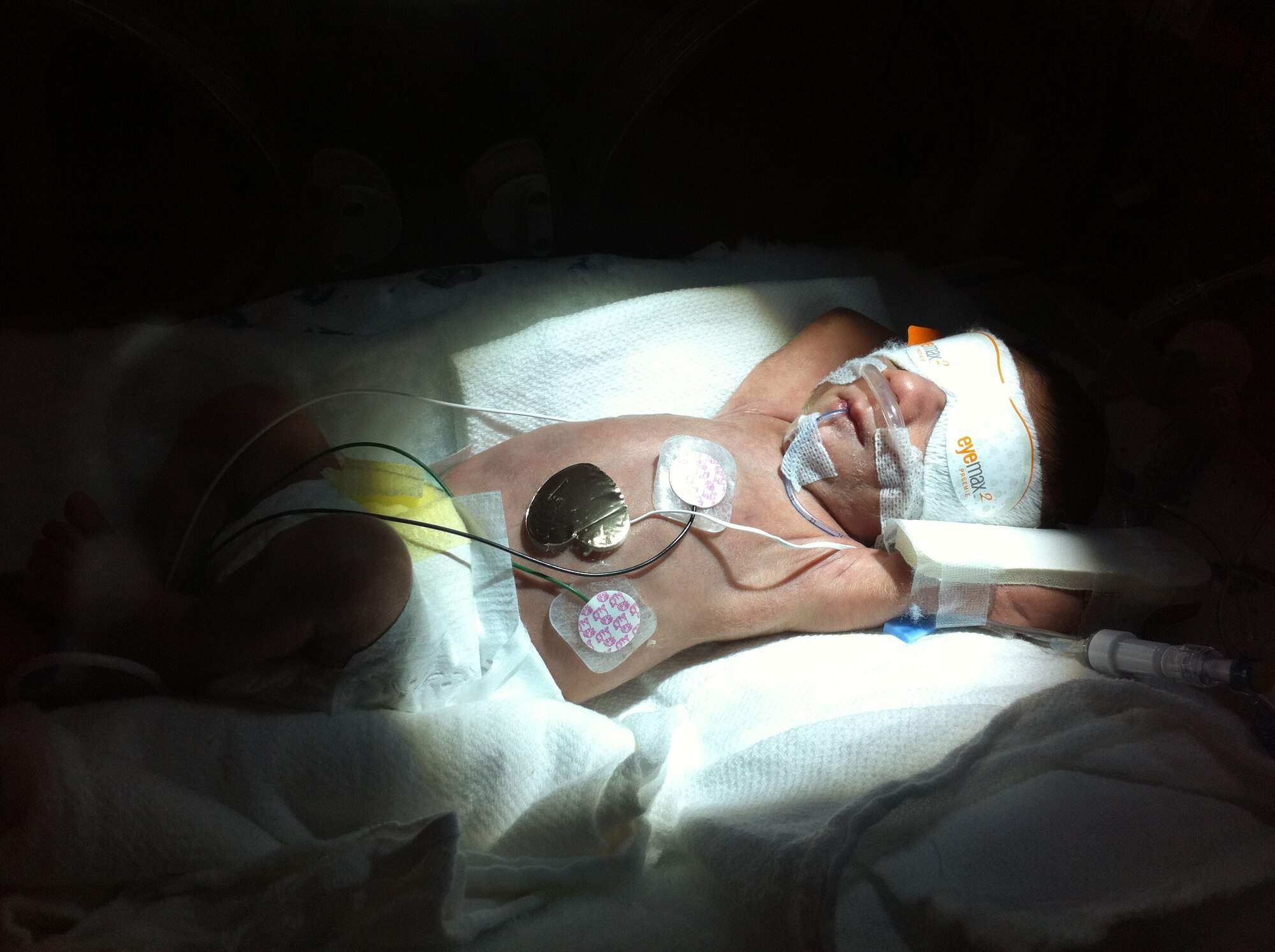 VANDENBERG AIR FORCE BASE, Calif. -- Rocco Picariello, three-day-old son of Capt. Joseph Picariello and Staff Sgt. Erica Picariello, lounges under bili-lights in an isolate November 28, 2011. Rocco, and his twin brother, Enzo, was born 10 weeks early and stayed in a neonatal intensive care unit for six weeks. (Courtesy photo)
