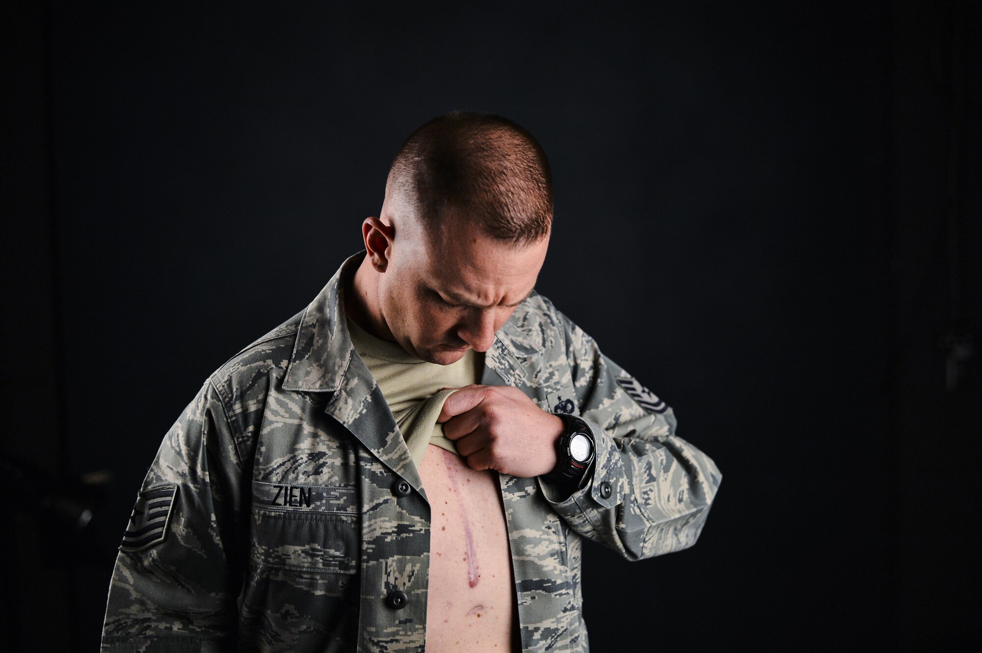 Tech. Sgt. Matthew Zien shows his scars from a life-saving operation that replaced two heart valves and took away vegetation from around his heart. He was in an induced coma for more than 42 hours during the open-heart surgery. (U.S. Air Force photo/Senior Airman Riley Johnson)
