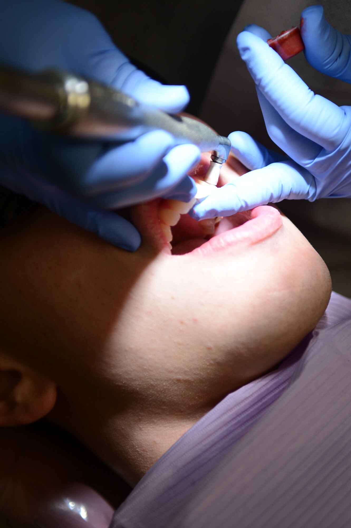 Staff Sgt. Tonya Collett, 20th Dental Squadron dental technician, polishes the teeth of Senior Airman Colin Casey, 20th DS lab technician, after a cleaning at Shaw Air Force Base, S.C., Sept. 30, 2013. The cleaning included using a cavitron, which is an ultrasonic tool that uses water vibrations to break apart plaque, followed by a pick to pull out any plaque remains before polishing the teeth. (U. S. Air Force photo by Airman 1st Class Krystal M. Jeffers/Released)