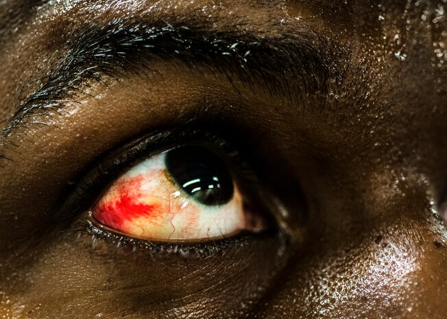 Senior Airman Martin Jackson, 628th Security Forces Squadron patrolman, has his eye looked at after another trainees fingers grazed his right eye during Phoenix Training at the Joint Base Charleston, S.C, Phoenix Raven training facility Oct. 10, 2013. Jackson’s eye was not injured, but anytime even the slightest scratch occurs the trainees are medically evaluated before being able to return to the intense training. Jackson and two other security forces members went through a three-week course at the JB Charleston Phoenix Raven facility to prepare them for the Phoenix Raven training course at the United States Air Force Expeditionary Center at Joint Base McGuire-Dix-Lakehurst, N.J. (U.S. Air Force photo/ Senior Airman Dennis Sloan)