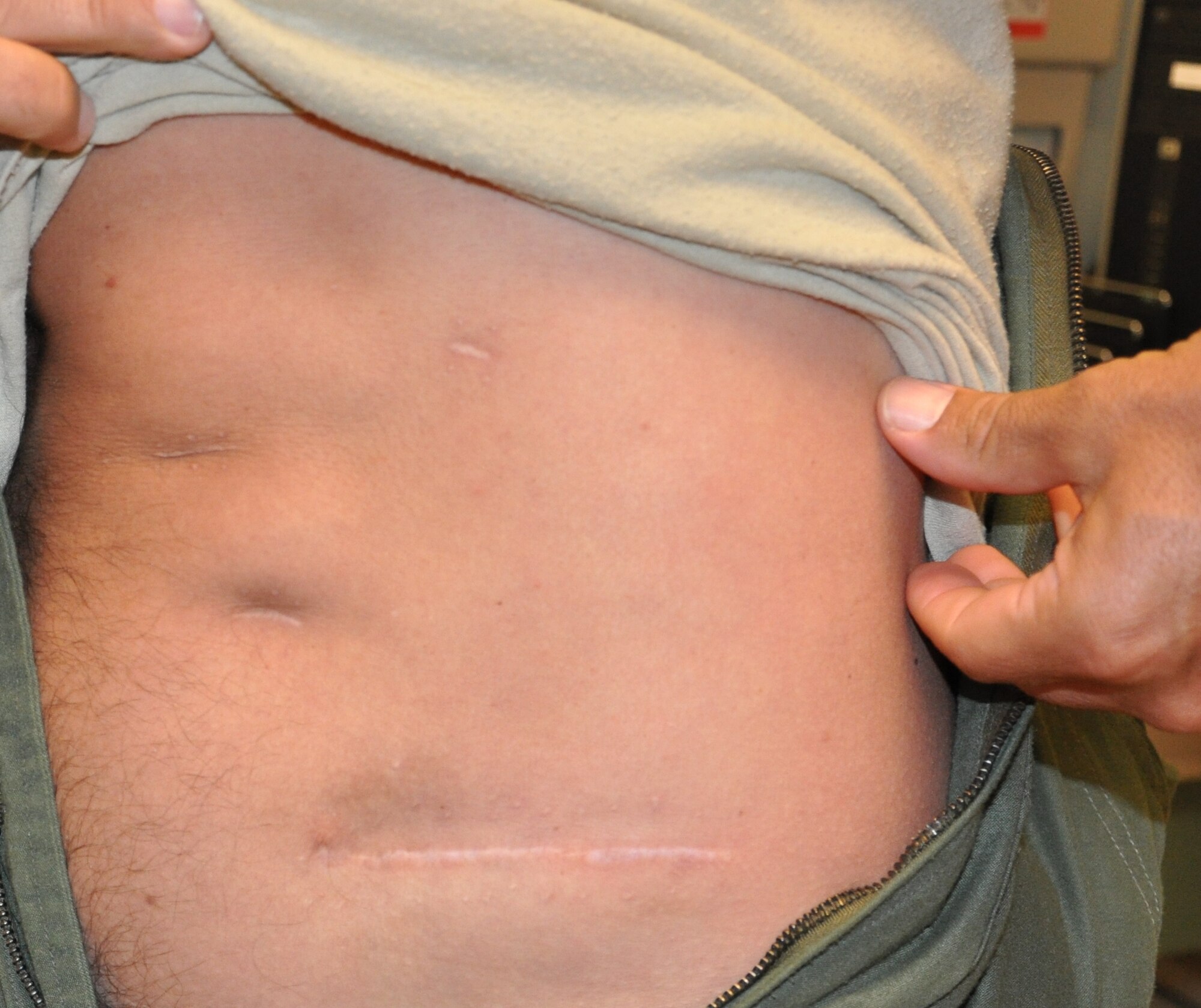 Col. David Barnes, 618th Air and Space Operations Center (Tanker Airlift Control Center) senior director of operations, shows the scars resulting from his cancer removal surgery. Barnes was diagnosed with cancer September 2012. (U.S. Air Force photo/Staff Sgt. Amber R. Kelly-Herard)
