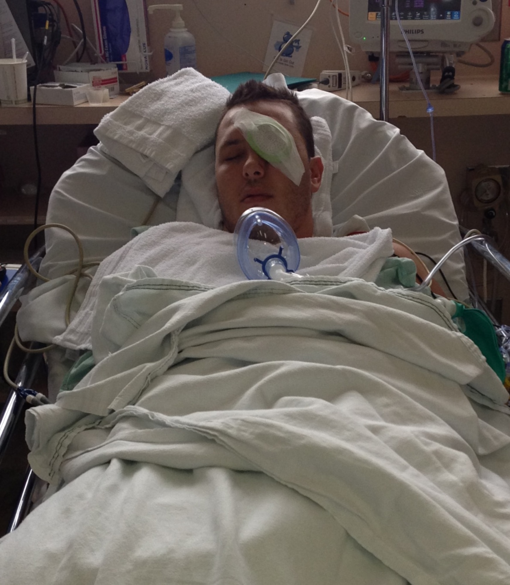 Tech. Sgt. Chris Hart, 647th Force Support Squadron unit training manager, recovers after a surgery to remove cancerous melanoma from his eye on Aug. 8. (Courtesy photo)