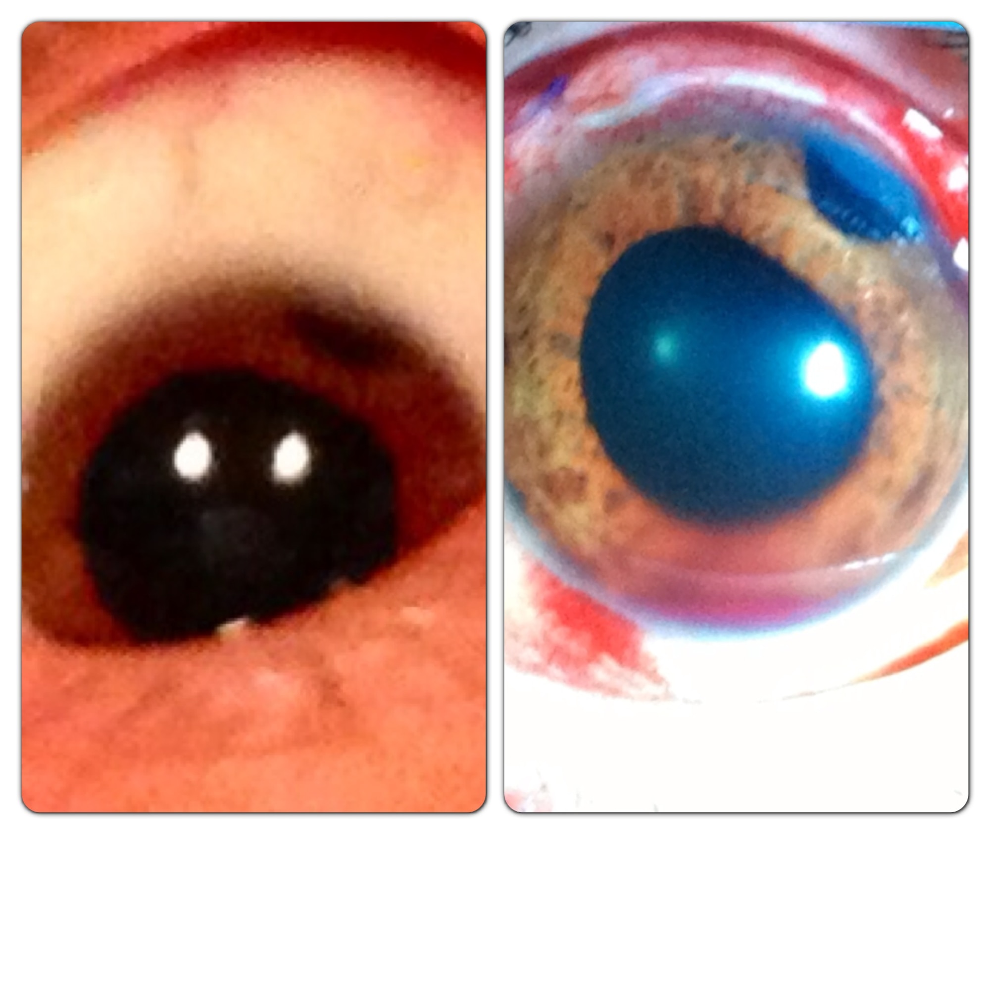 From left to right: This picture shows Tech. Sgt. Chris Hart, 647th Force Support Squadron unit training manager's eye before and after his surgery to remove cancerous melanoma. Hart received treatment at the University of California, San Francisco on Aug. 8 and is currently recovering in the local area. (Courtesy photo)