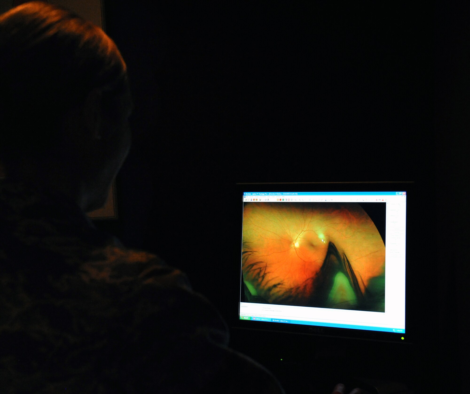 Capt. Lauren Pfendler, 2nd Aerospace Medical Squadron optometrist, analyzes a patient's retina on Barksdale Air Force Base, La., March 26, 2014. During an eye exam, the optometrist will take a photo of a patient's eye and look at the image to see if there are any vision or life threatening diseases. (U.S. Air Force photo/Senior Airman Benjamin Gonsier)
