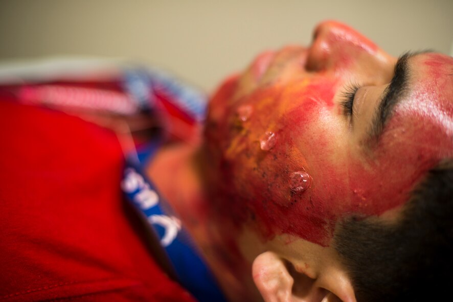 A patient waiting for transport lies on a litter during a chemical, biological, radiological and nuclear major accident response exercise at Moody Air Force Base, Ga., April 3, 2014. The exercise was designed to test a wide spectrum of Moody’s capabilities including responding to and decontaminating a hazardous zone after an attack. (U.S. Air Force photo by Airman 1st Class Ryan Callaghan/Released)