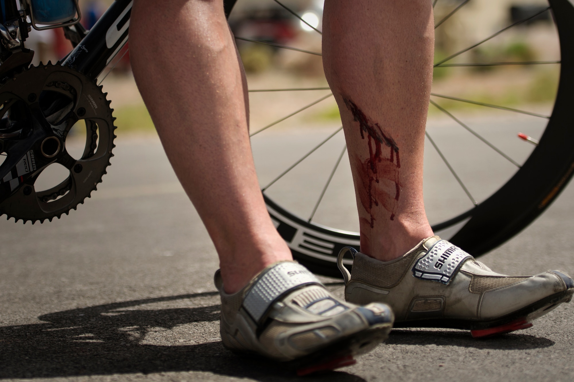 Mitchell Kieffer bleeds from a cut suffered during the cycling portion of the Air Force Trials April 9, 2014, at Nellis Air Force Base, Nev.  Sliced by his gear, Kieffer was still all smiles after finishing first in his category for the 18-mile men’s bicycle open.  Kiefer is an Air Force wounded warrior.  (U.S. Air Force photo/Senior Airman Jette Carr) 